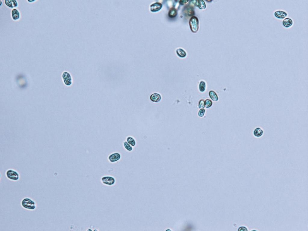 250211-269-gly-0min-1-copy (c) Microscopy Image of cryptophyte algae
(c) Desmond Toa