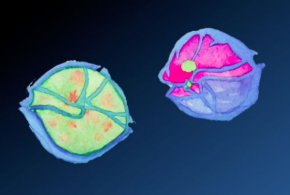 Dinoflagellate Alexandrium (c) Aquarellbild eines gesunden Dinoflagellaten Alexandrium (links) und eines von Amoebophrya befallenen (rechts), (c) Yameng Lu