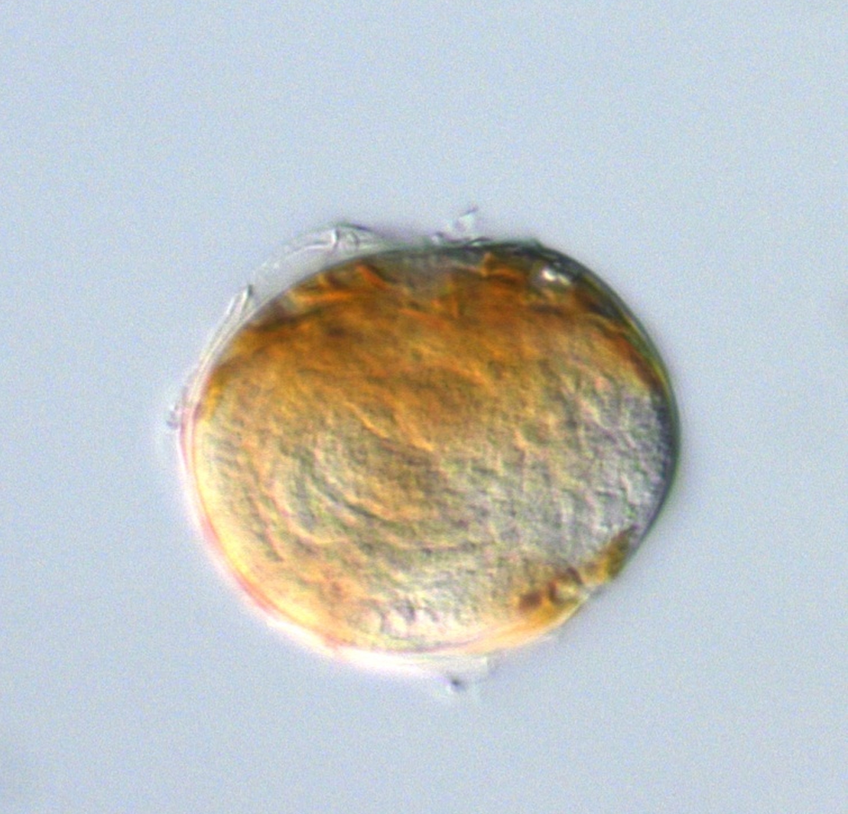 Dinoflagellate Alexandrium (c) Dinoflagellat Alexandrium, der vom Parasiten Amoebophrya befallen ist, unter dem Mikroskop, (c) Yameng Lu